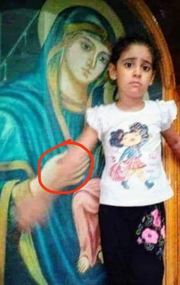 Mâna dreaptă a Maicii Domnului ținea mâna bolnavă a fetiței